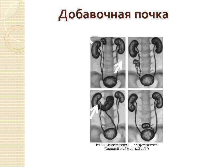 Добавочная почка 