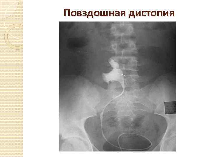 Повздошная дистопия 