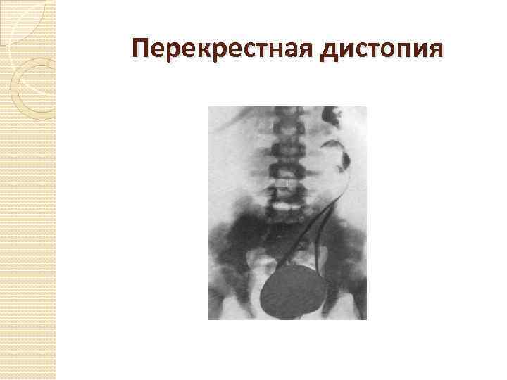 Перекрестная дистопия 
