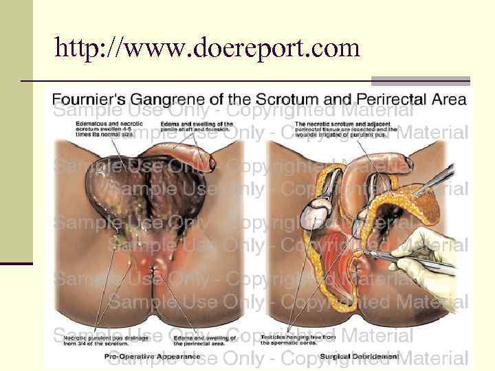 http: //www. doereport. com 