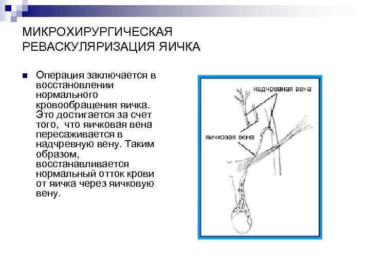 МИКРОХИРУРГИЧЕСКАЯ РЕВАСКУЛЯРИЗАЦИЯ ЯИЧКА n Операция заключается в восстановлении нормального кровообращения яичка. Это достигается за