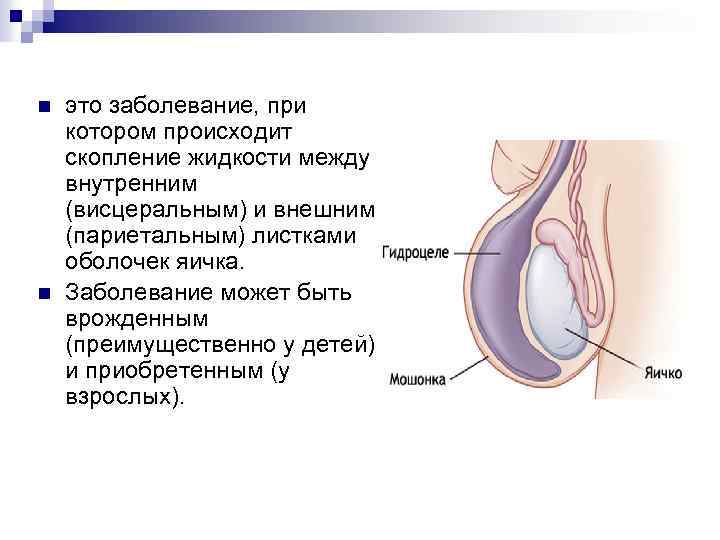 n n это заболевание, при котором происходит скопление жидкости между внутренним (висцеральным) и внешним
