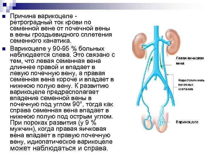n n Причина варикоцеле - ретроградный ток крови по семенной вене от почечной вены