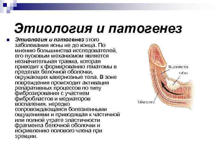 Этиология и патогенез n Этиология и патогенез этого заболевания ясны не до конца. По