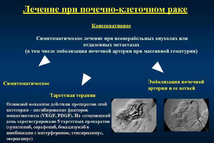 Лечение при почечно-клеточном раке Консервативное Симптоматическое лечение при неоперабельных опухолях или отдаленных метастазах (в