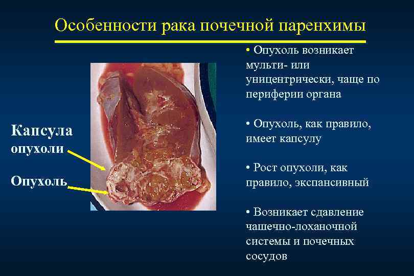 Паренхима почки фото