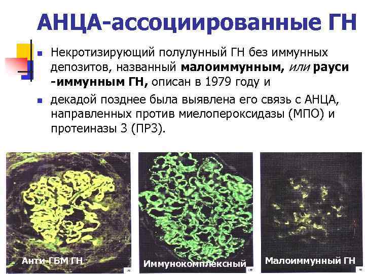 Антинейтрофильные цитоплазматические антитела