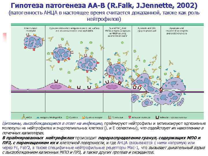 Гипотеза патогенеза АА-В (R. Falk, J. Jennette, 2002) R. Falk (патогенность АНЦА в настоящее