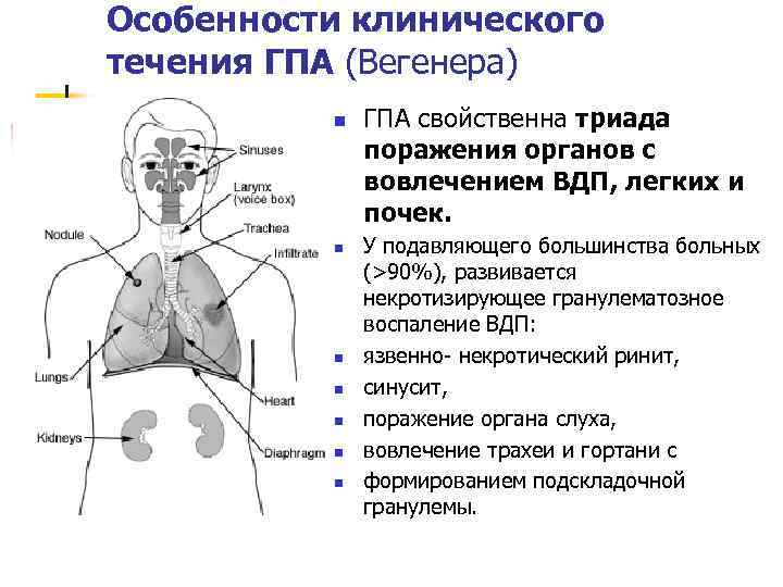 Особенности клинического течения ГПА (Вегенера) n n n n ГПА свойственна триада поражения органов