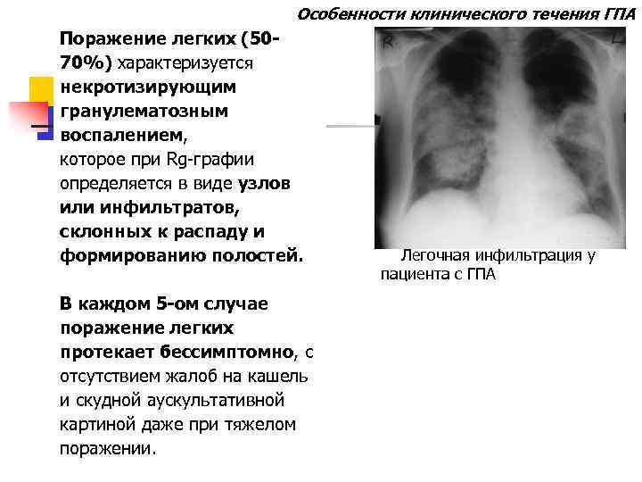 50 легких