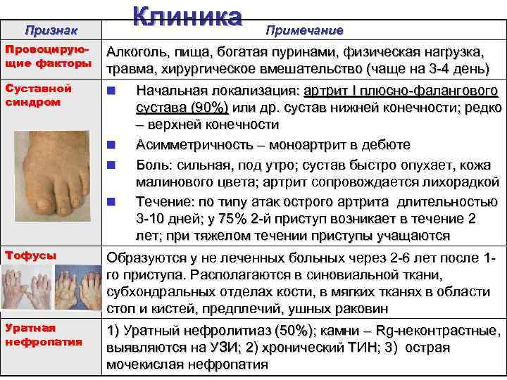 Клиника Признак Примечание Провоцирующие факторы Алкоголь, пища, богатая пуринами, физическая нагрузка, травма, хирургическое вмешательство