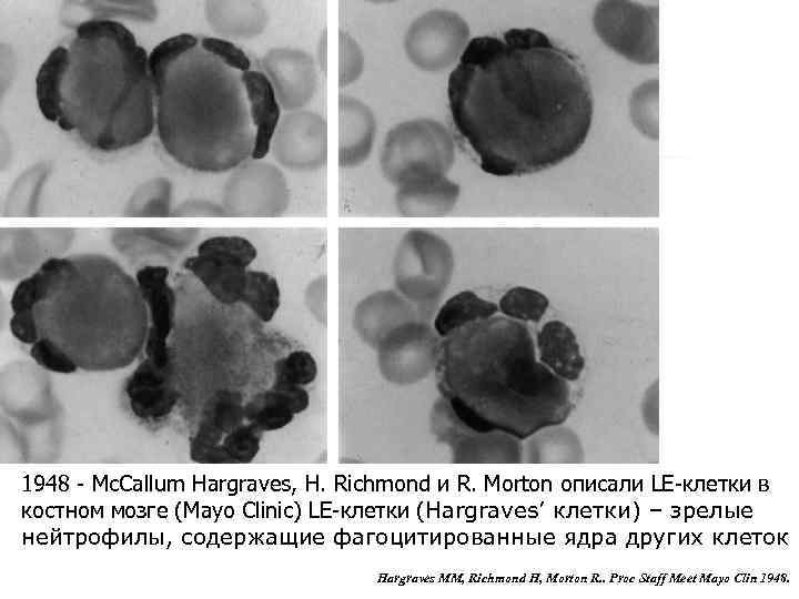  1948 - Мс. Callum Hargraves, H. Richmond и R. Morton описали LE-клетки в