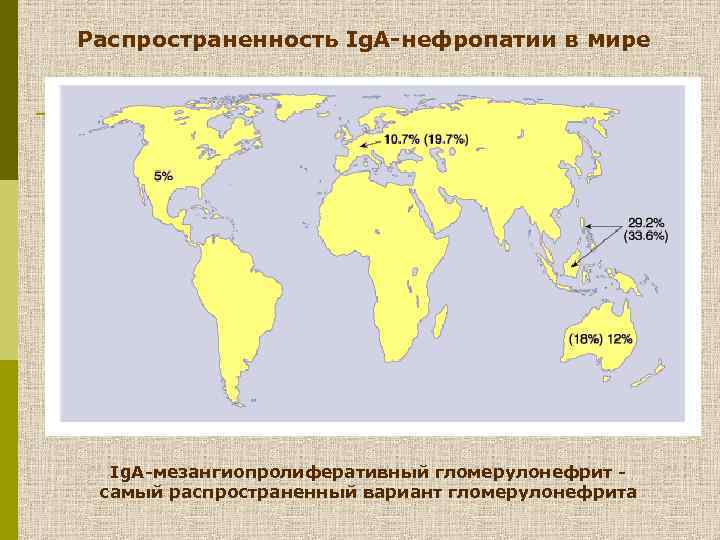 Распространенность Ig. А-нефропатии в мире Ig. А-мезангиопролиферативный гломерулонефрит самый распространенный вариант гломерулонефрита 