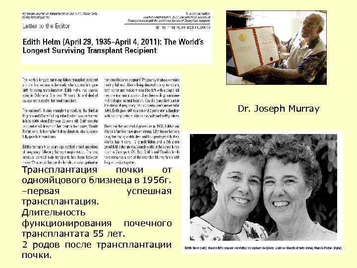 Dr. Joseph Murray Трансплантация почки от однояйцового близнеца в 1956 г. –первая успешная трансплантация.