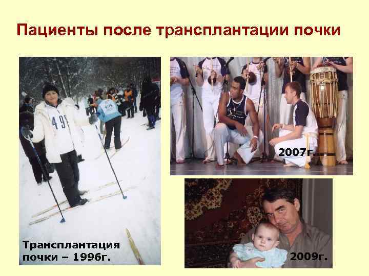 Пациенты после трансплантации почки 2007 г. Трансплантация почки – 1996 г. 2009 г. 