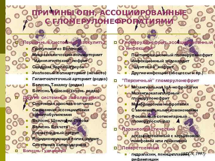 ПРИЧИНЫ ОПН, АССОЦИИРОВАННЫЕ С ГЛОМЕРУЛОНЕФРОПАТИЯМИ p Первичные системные васкулиты n n n n Гранулематоз