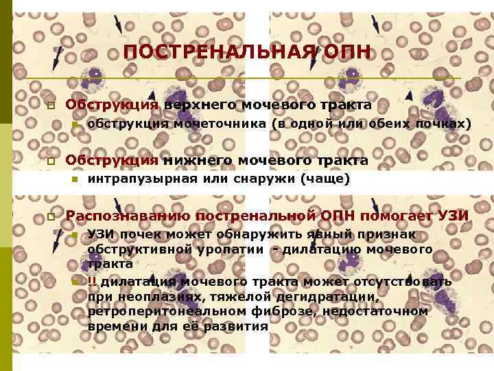 ПОСТРЕНАЛЬНАЯ ОПН p Обструкция верхнего мочевого тракта n p Обструкция нижнего мочевого тракта n