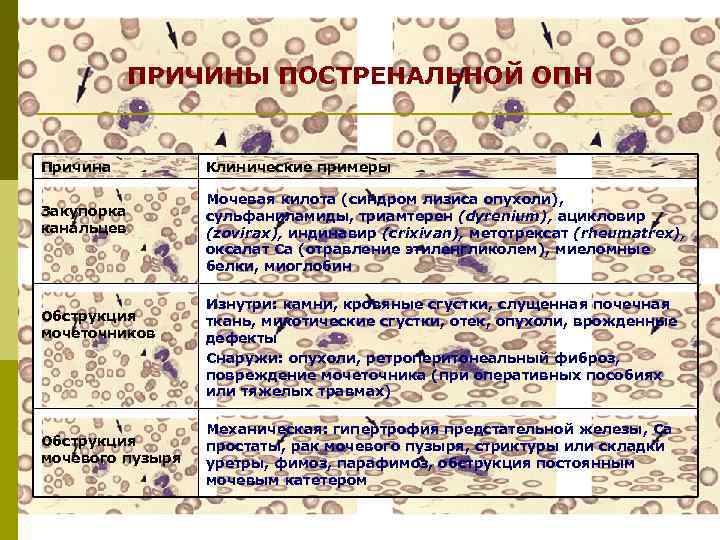 ПРИЧИНЫ ПОСТРЕНАЛЬНОЙ ОПН Причина Закупорка канальцев Обструкция мочеточников Обструкция мочевого пузыря Клинические примеры Мочевая