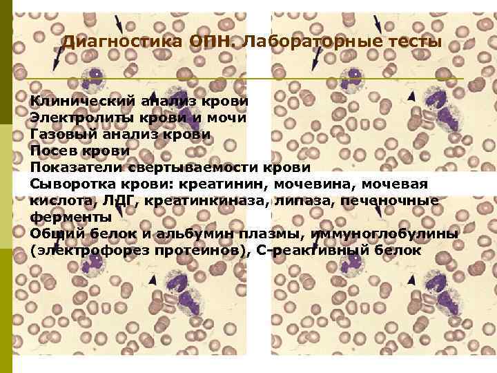 Диагностика ОПН. Лабораторные тесты Клинический анализ крови Электролиты крови и мочи Газовый анализ крови