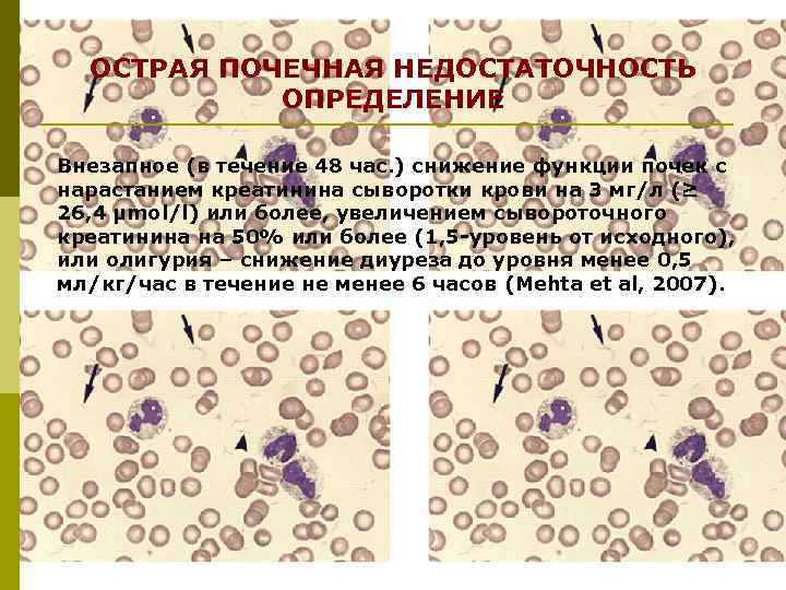 ОСТРАЯ ПОЧЕЧНАЯ НЕДОСТАТОЧНОСТЬ ОПРЕДЕЛЕНИЕ Внезапное (в течение 48 час. ) снижение функции почек с