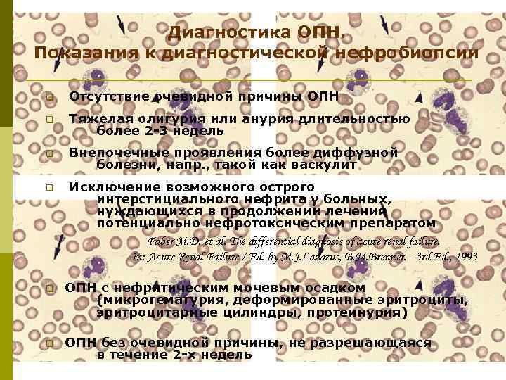 Диагностика ОПН. Показания к диагностической нефробиопсии q Отсутствие очевидной причины ОПН q Тяжелая олигурия