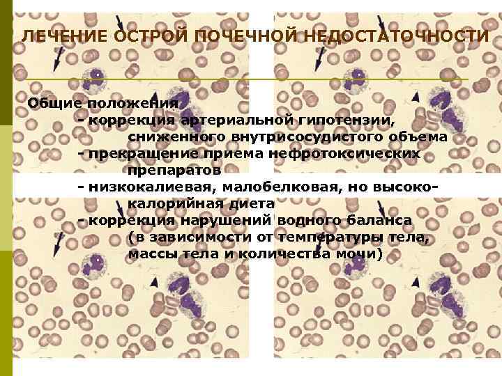 ЛЕЧЕНИЕ ОСТРОЙ ПОЧЕЧНОЙ НЕДОСТАТОЧНОСТИ Общие положения - коррекция артериальной гипотензии, сниженного внутрисосудистого объема -