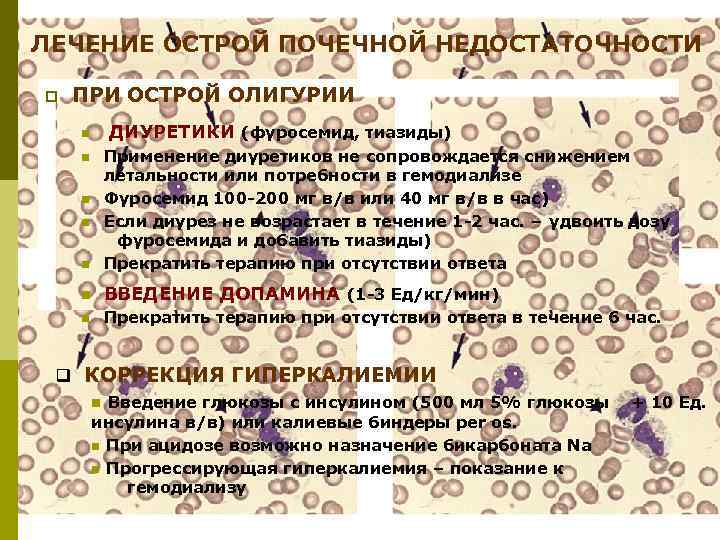 ЛЕЧЕНИЕ ОСТРОЙ ПОЧЕЧНОЙ НЕДОСТАТОЧНОСТИ p ПРИ ОСТРОЙ ОЛИГУРИИ n ДИУРЕТИКИ (фуросемид, тиазиды) Применение диуретиков