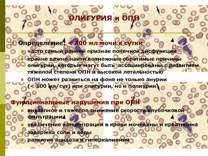 ОЛИГУРИЯ и ОПН p Определение: < 400 мл мочи в сутки n часто самый