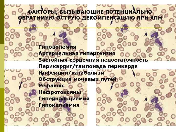 ФАКТОРЫ, ВЫЗЫВАЮЩИЕ ПОТЕНЦИАЛЬНО ОБРАТИМУЮ ОСТРУЮ ДЕКОМПЕНСАЦИЮ ПРИ ХПН Гиповолемия Артериальная гипертензия Застойная сердечная недостаточность