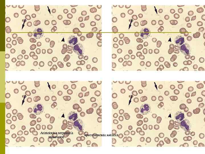  Aristolochia serpentaria snakewood аристолоховая кислота 