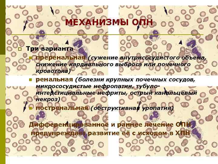 МЕХАНИЗМЫ ОПН p Три варианта n преренальная (сужение внутрисосудистого объема, снижение кардиального выброса или