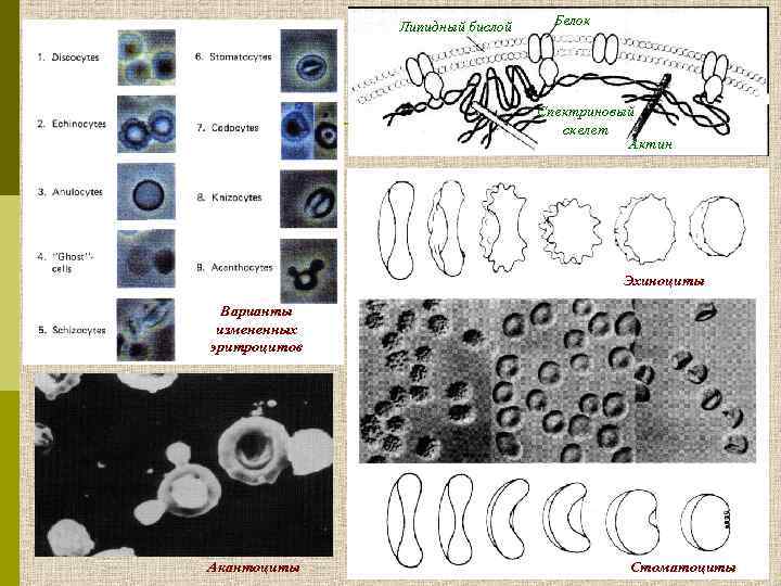 Липидный бислой Белок Спектриновый скелет Актин Эхиноциты Варианты измененных эритроцитов Акантоциты Стоматоциты 