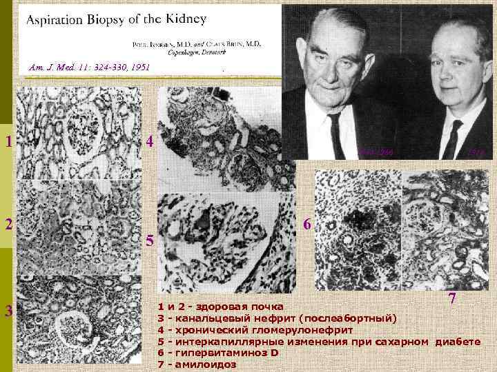 Am. J. Med. 11: 324 -330, 1951 1 2 3 4 1884 -1966 1914