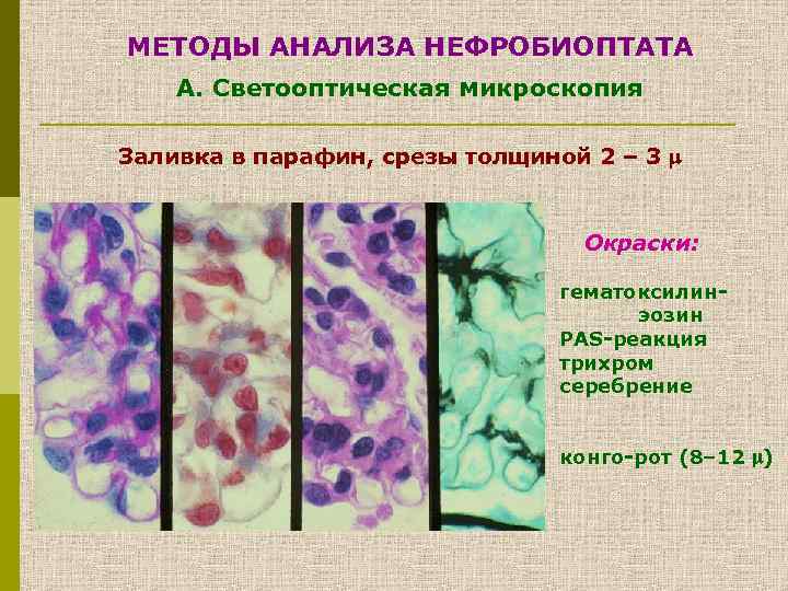 МЕТОДЫ АНАЛИЗА НЕФРОБИОПТАТА А. Светооптическая микроскопия Заливка в парафин, срезы толщиной 2 – 3