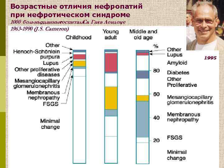 Возрастные отличия нефропатий при нефротическом синдроме 1000 больныхданные , госпиталя Гая в Лондоне Св.