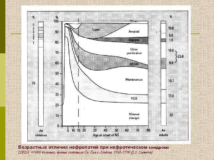 Возрастные отличия нефропатий при нефротическом синдроме ISKDS +1000 больных, данные госпиталя Св. Гая в