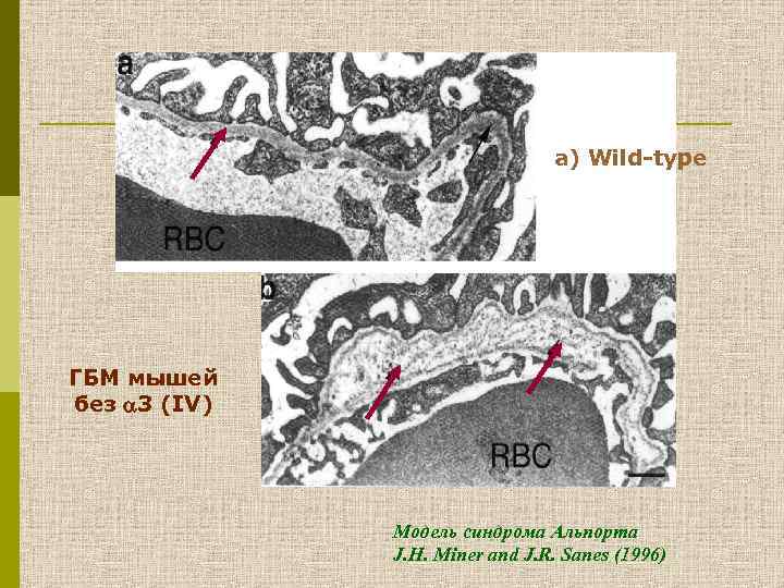 a) Wild-type ГБМ мышей без 3 (IV) Модель синдрома Альпорта J. H. Miner and