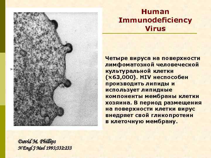 Human Immunodeficiency Virus Четыре вируса на поверхности лимфоматозной человеческой культуральной клетки (× 63, 000).