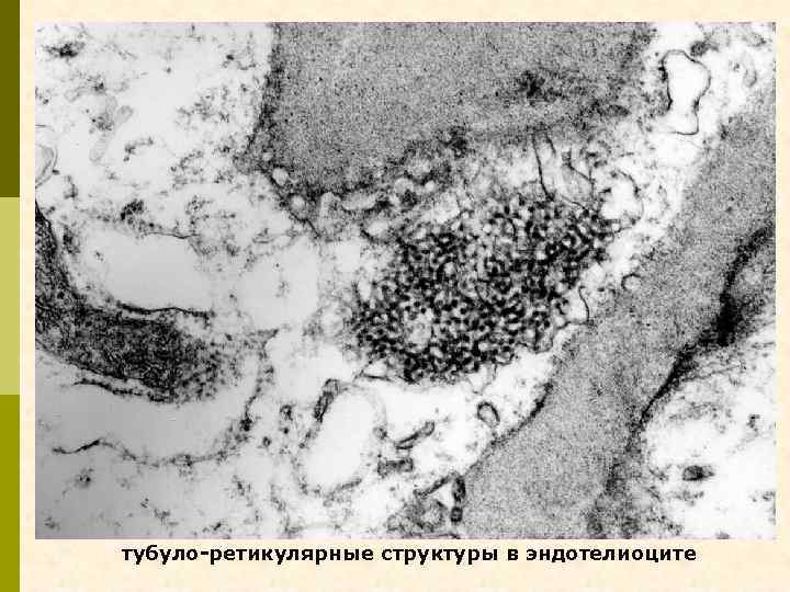 тубуло-ретикулярные структуры в эндотелиоците 