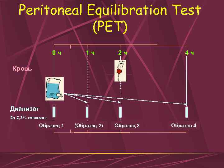 Peritoneal Equilibration Test (PET) 0 ч 1 ч 2 ч 4 ч Кровь Диализат
