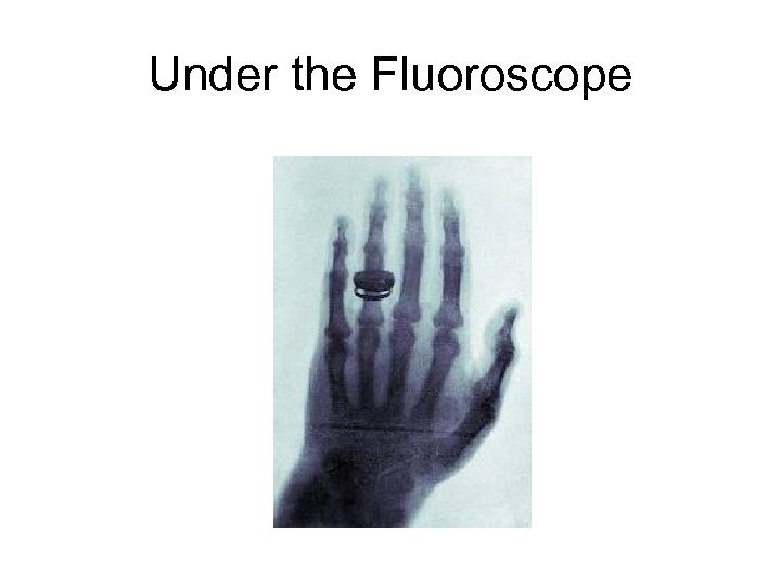 Under the Fluoroscope 
