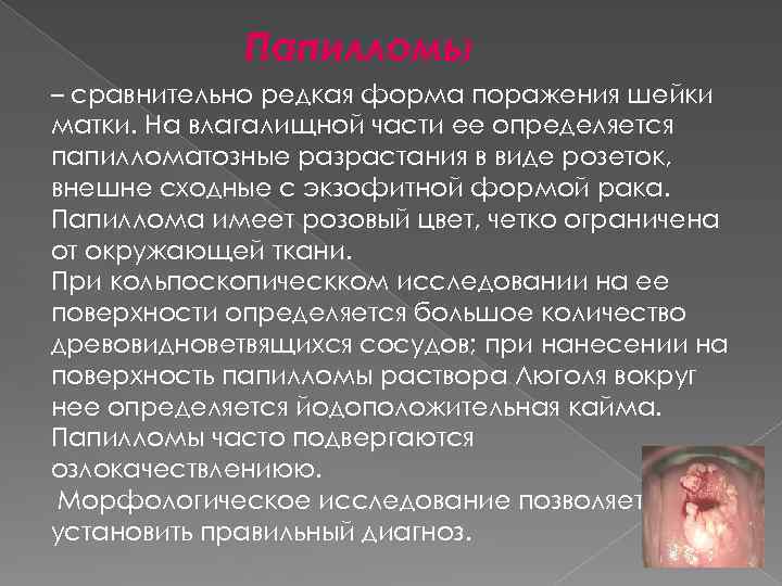 Папилломы – сравнительно редкая форма поражения шейки матки. На влагалищной части ее определяется папилломатозные
