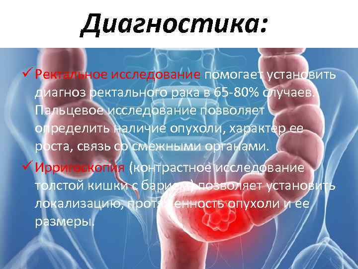 Ректальное исследование. К чему снится болезнь у себя во сне. Видеть во сне что заболел онкологией. К чему снится болезнь человека.