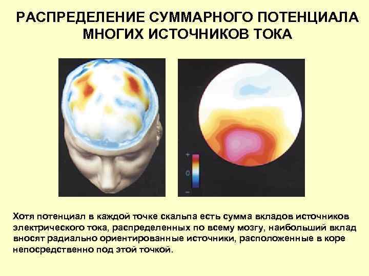 РАСПРЕДЕЛЕНИЕ СУММАРНОГО ПОТЕНЦИАЛА МНОГИХ ИСТОЧНИКОВ ТОКА Хотя потенциал в каждой точке скальпа есть сумма