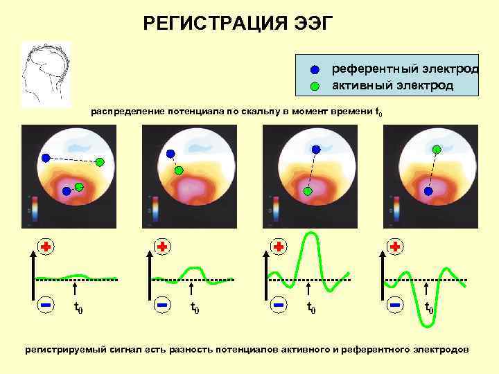 РЕГИСТРАЦИЯ ЭЭГ референтный электрод активный электрод распределение потенциала по скальпу в момент времени t