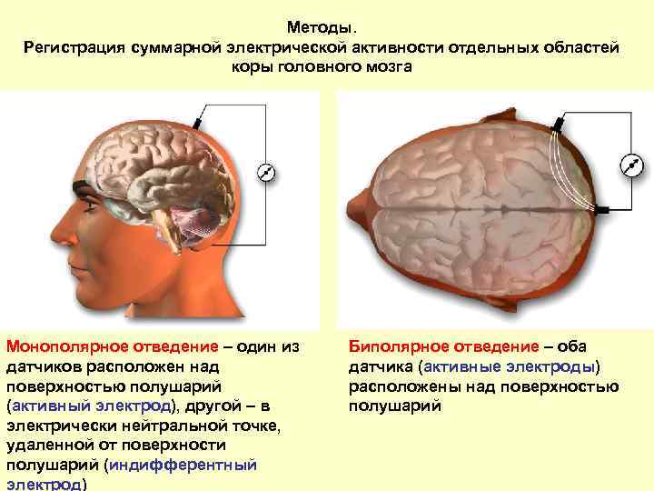 Методы. Регистрация суммарной электрической активности отдельных областей коры головного мозга Монополярное отведение – один