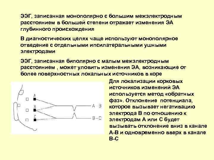 Схема наложения электродов ээг