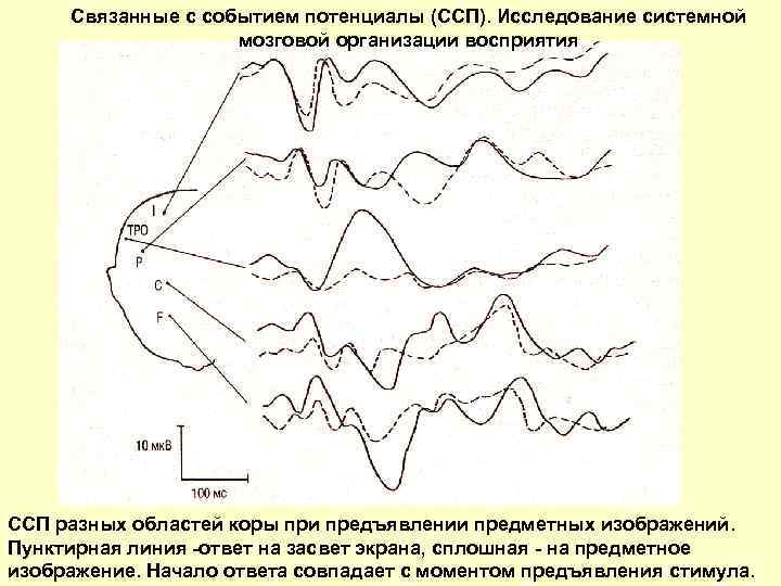 Cвязанные с событием потенциалы (ССП). Исследование системной мозговой организации восприятия ССП разных областей коры