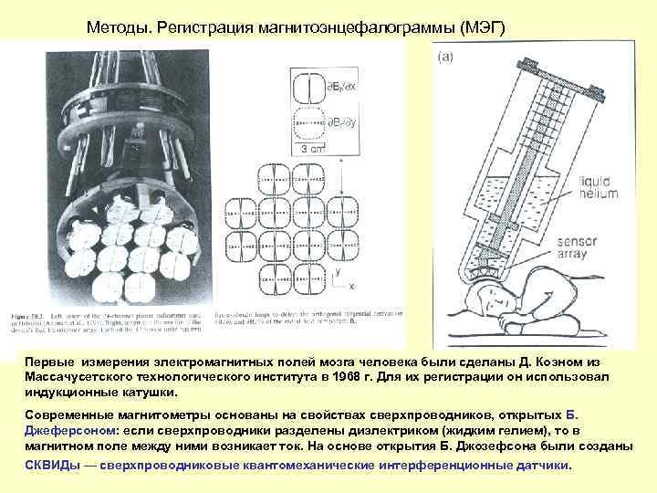 Методы. Регистрация магнитоэнцефалограммы (МЭГ) Первые измерения электромагнитных полей мозга человека были сделаны Д. Коэном