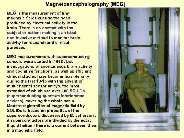 Magnetoencephalography (MEG) MEG is the measurement of tiny magnetic fields outside the head produced